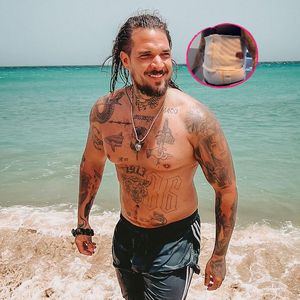 Schon zum zweiten Mal: Zico Banach ließ sich Fett absaugen!