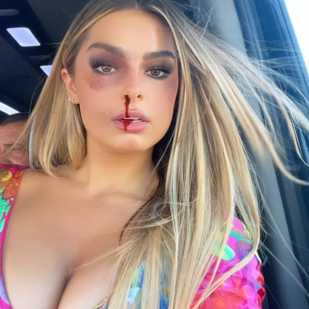 Addison Rae mit einem Nasenbluten-Filter