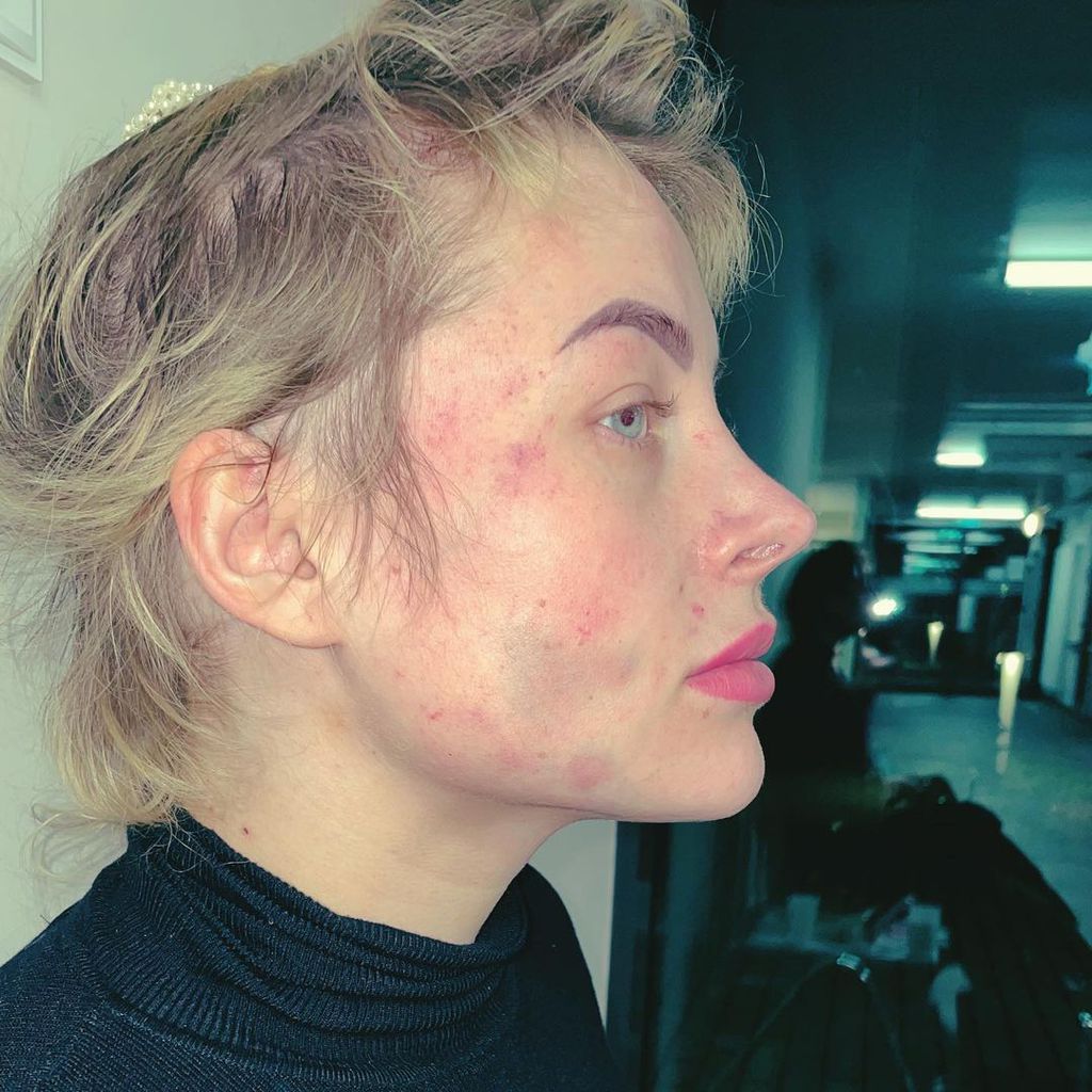 Aline Bachmann, Sängerin
