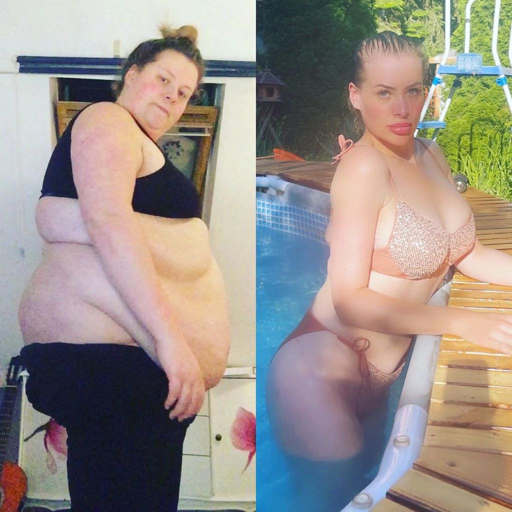 Aline Bachmann vor und nach ihrer Gewichtsabnahme