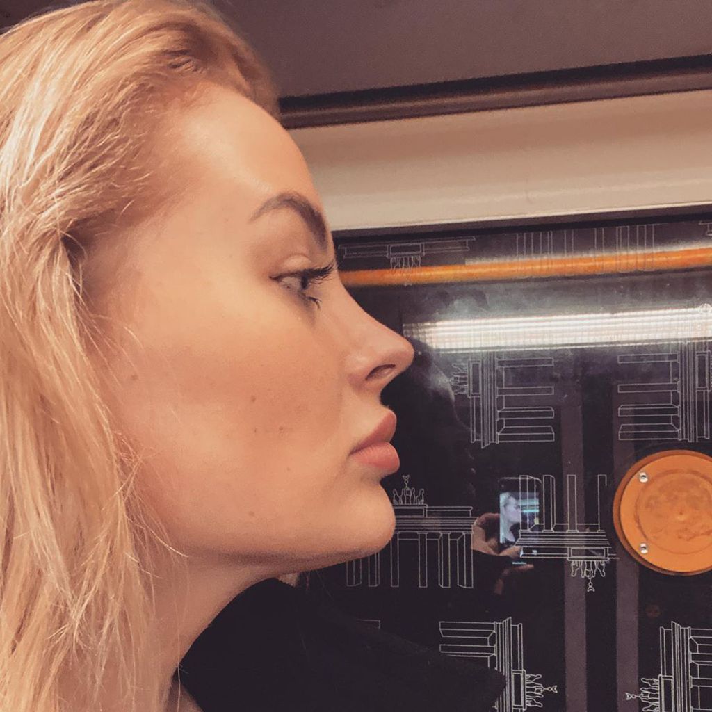 Aline Bachmann, Ex-DSDS-Kandidatin