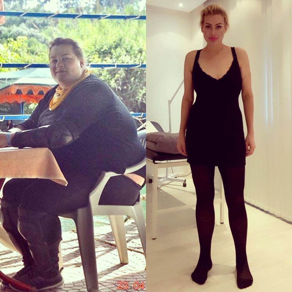 Aline Bachmann vor und nach ihrem Gewichtsverlust