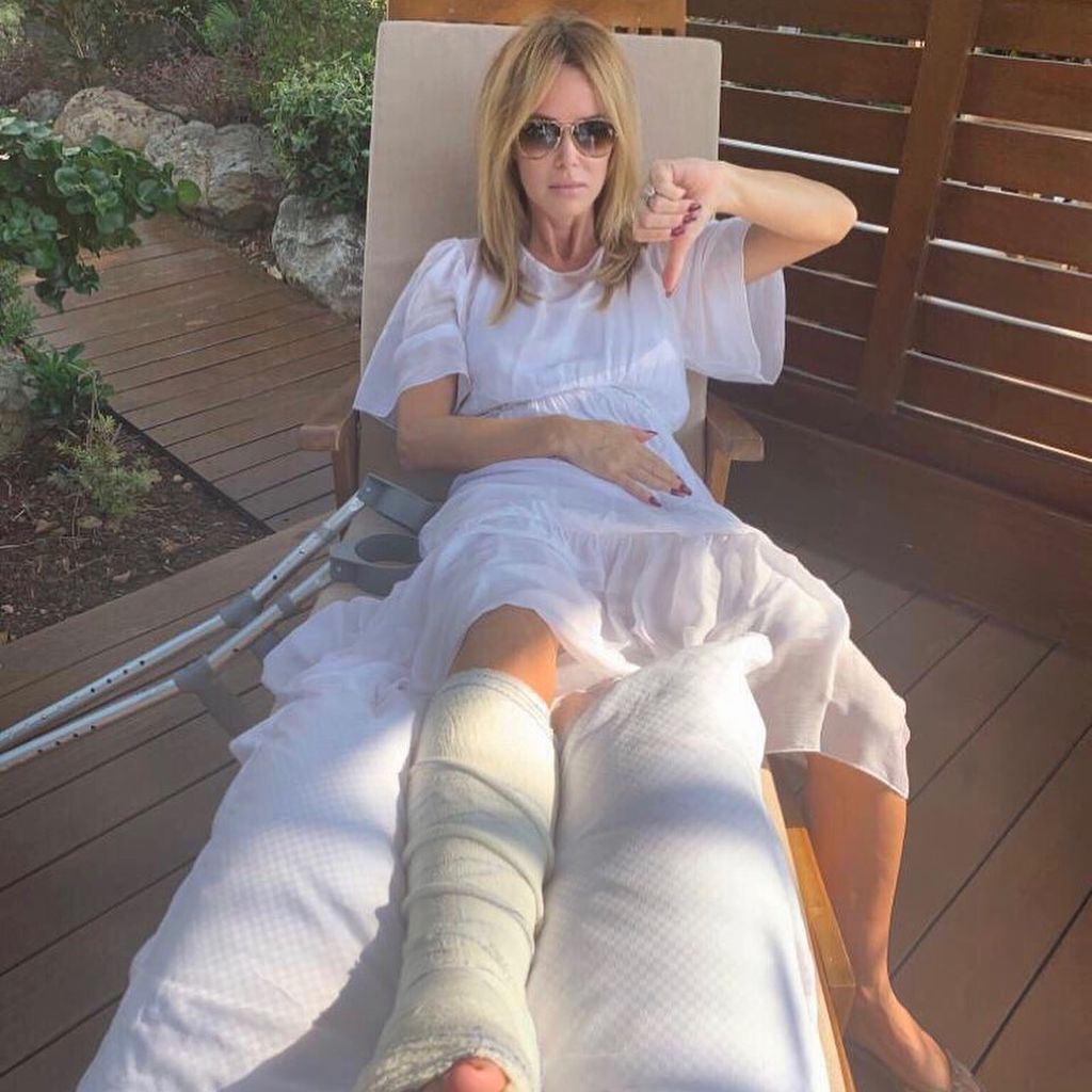 Amanda Holden mit Gips am Bein, Oktober 2019