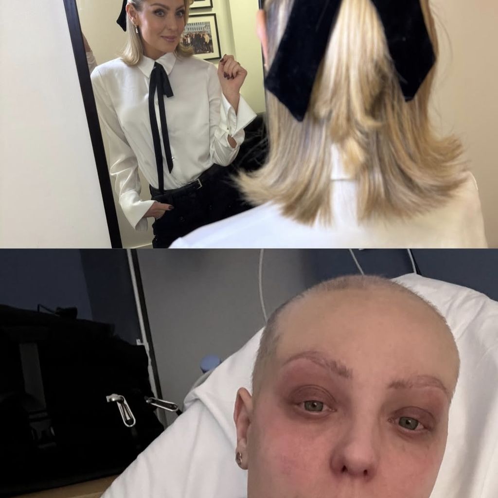 Amy Dowden teilt Vergleich nach Krebskampf