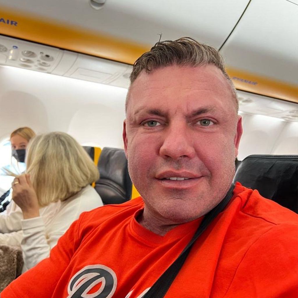 Andreas Robens nach seiner Falten-OP