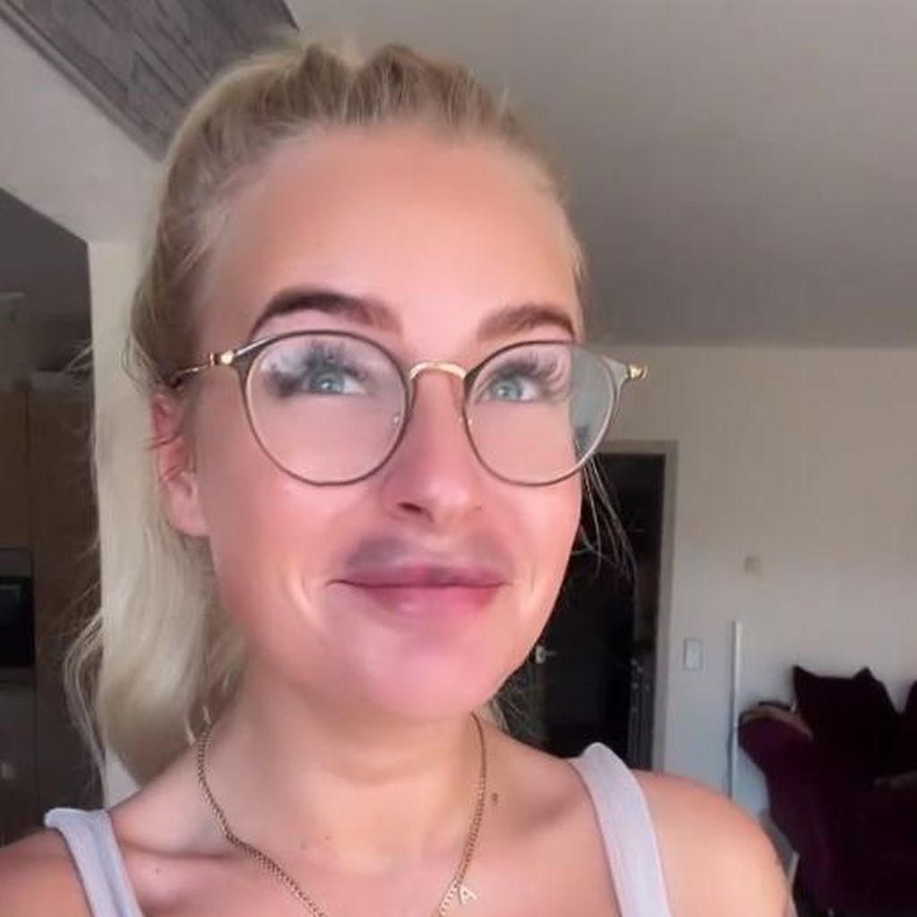 Anna Iffländers Lippen nach der Hyaluronauflösung, November 2022