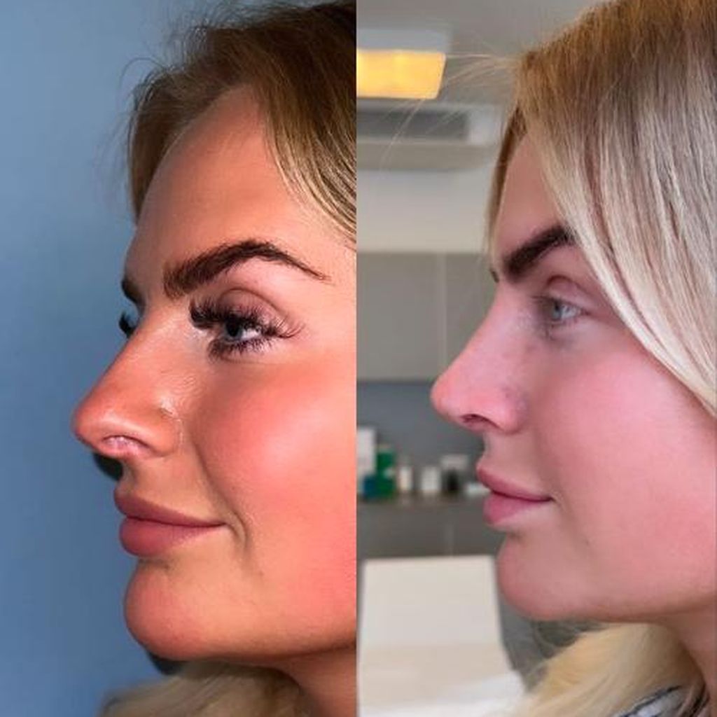 Anna Iffländer, Influencerin
