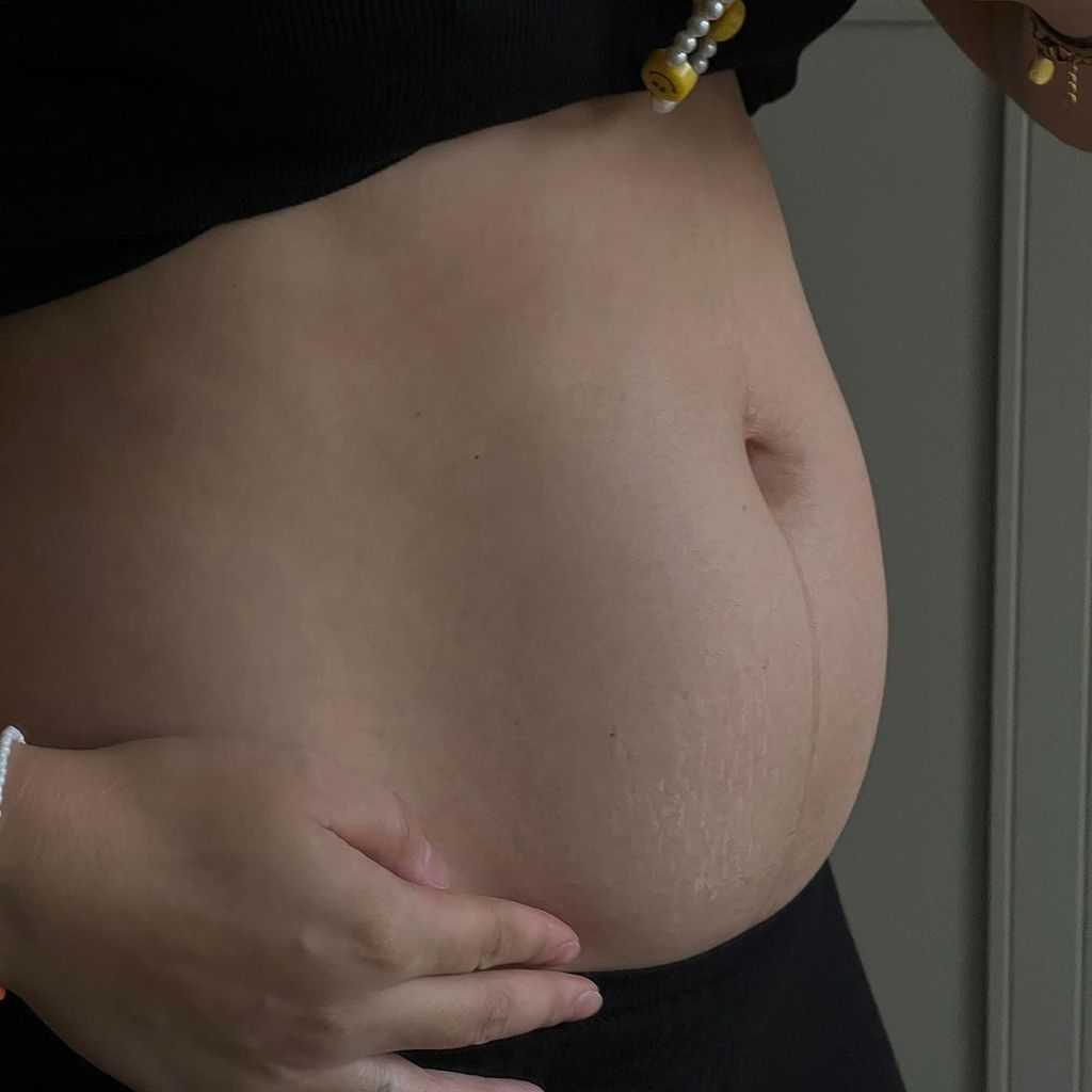 Anna Maria Damm zeigt ihren After-Baby-Body, November 2023