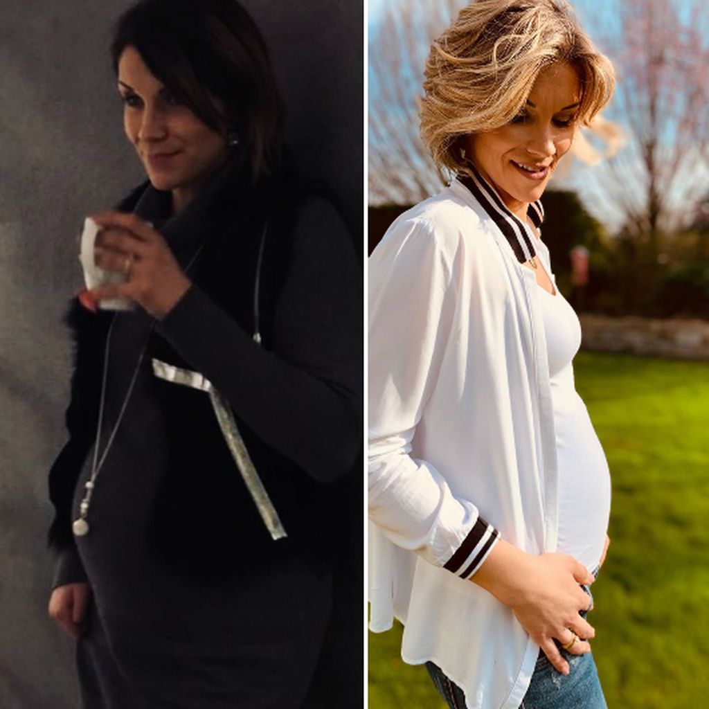 Anna-Maria Zimmermann in ihrer Schwangerschaft 2017 (links) und heute (rechts)