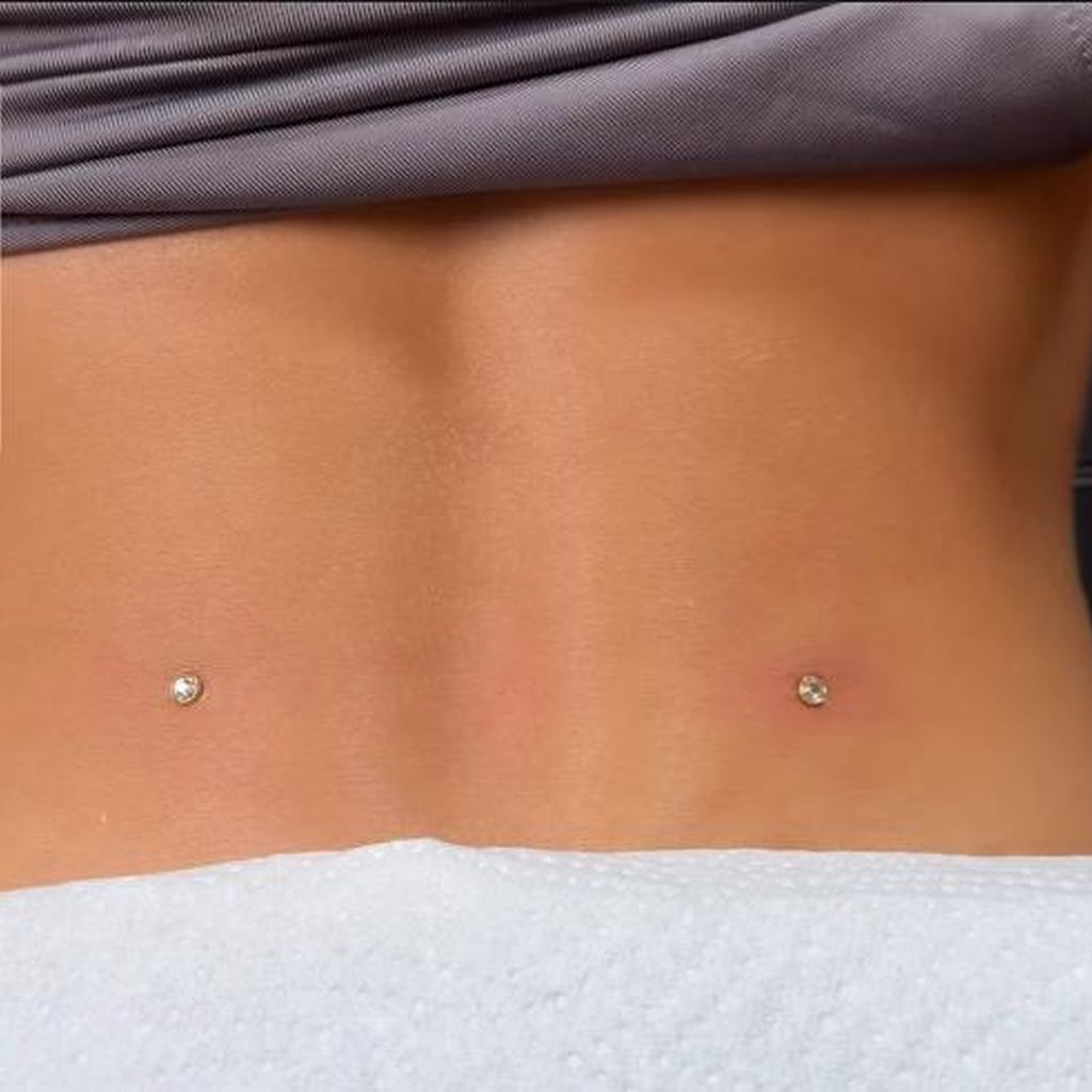 Ariels Dermal-Piercing am Rücken, Juli 2026