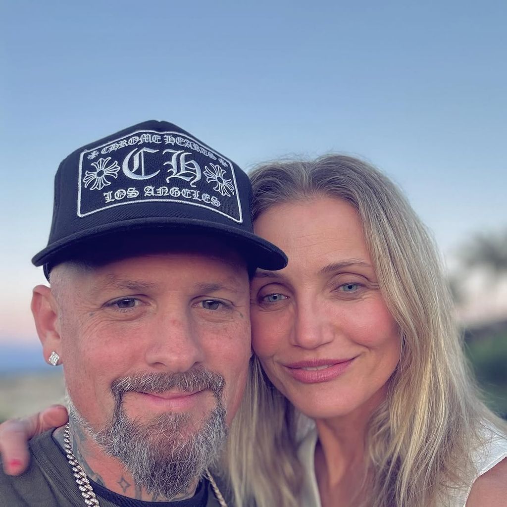 Benji Madden gratuliert Cameron Diaz mit diesem Bild zum 10. Hochzeitstag
