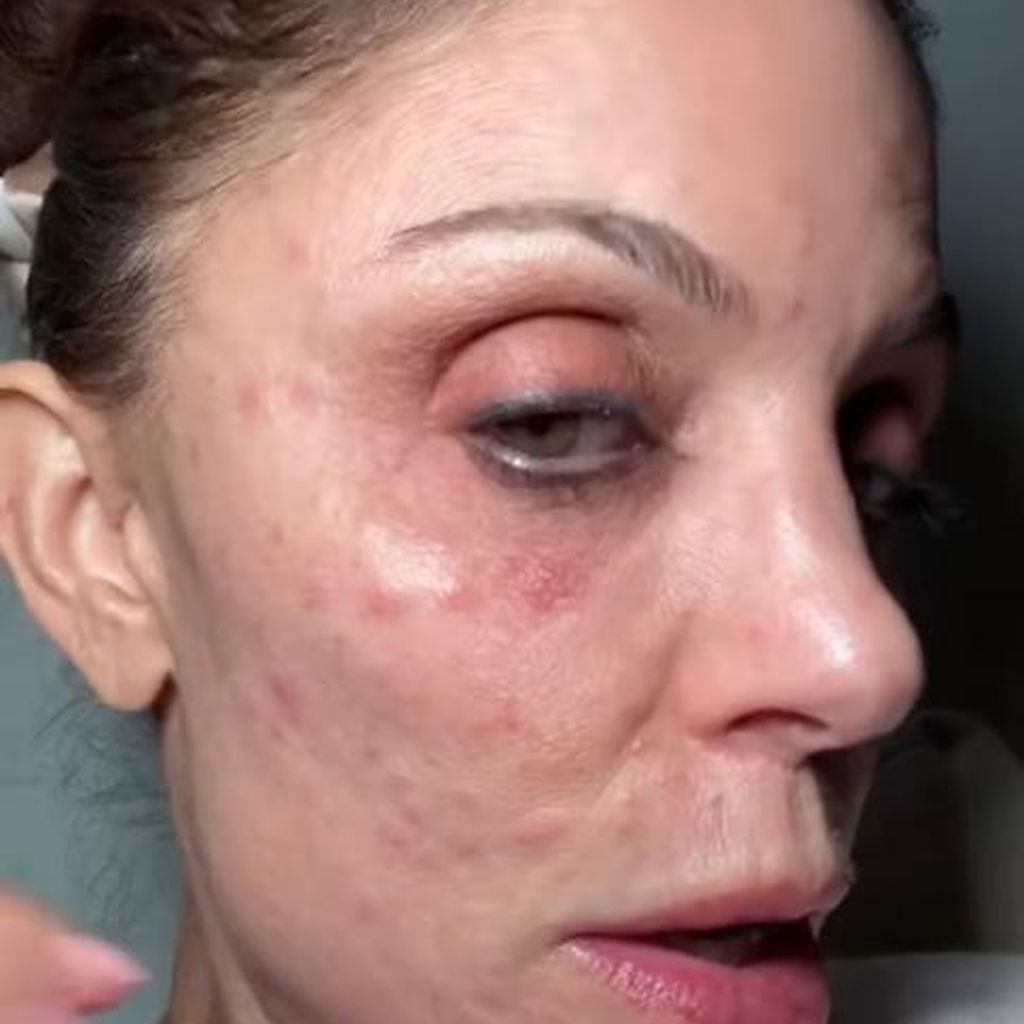 Bethenny Frankel, Januar 2026