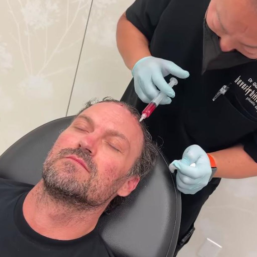 Brian Austin Green bei seiner Haarausfall-Behandlung