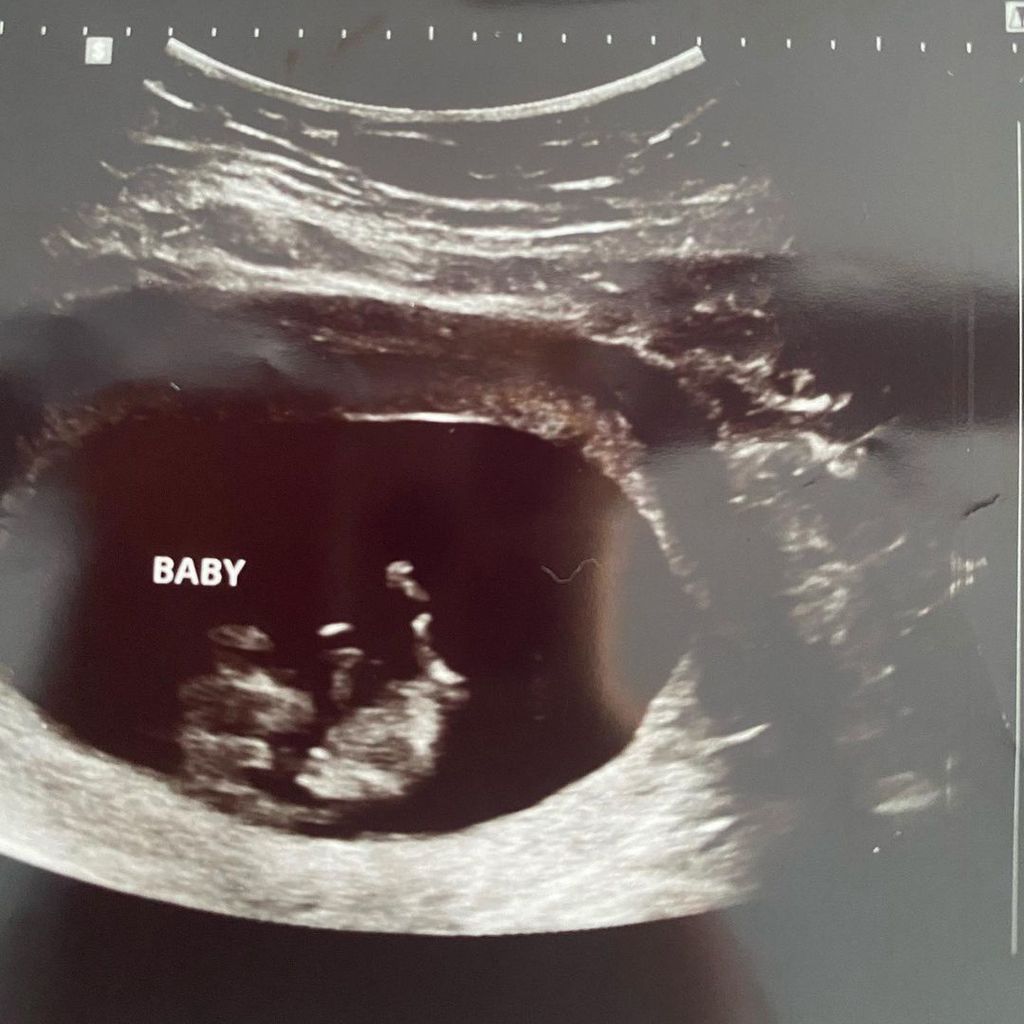 Catelynn Lowells Ultraschallbild, Februar 2021
