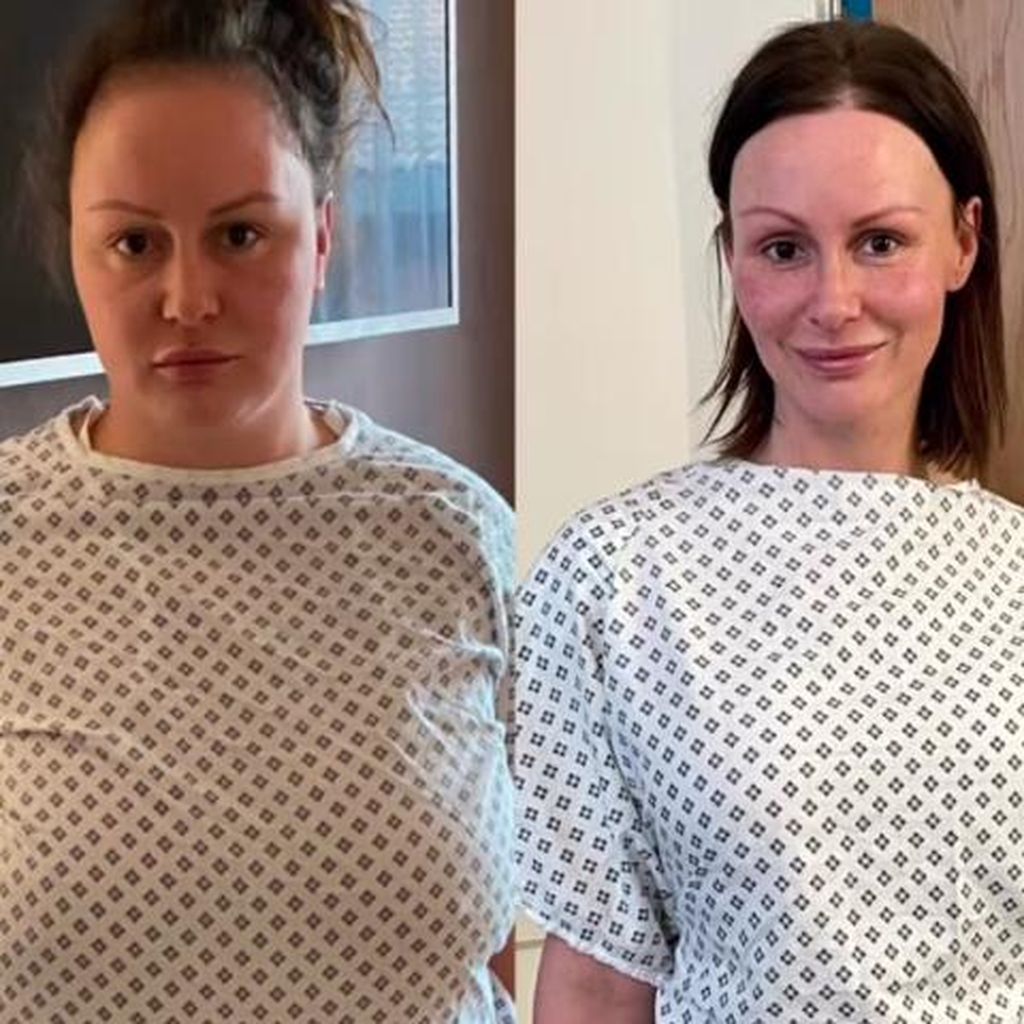 Chanelle Hayes' Verwandlung