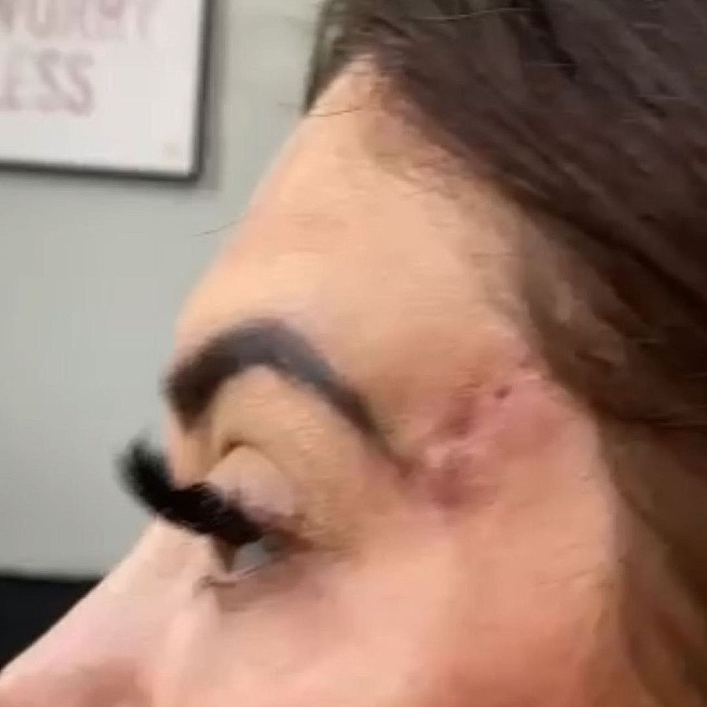 Chloe Ferry zeigt ihre OP-Narben