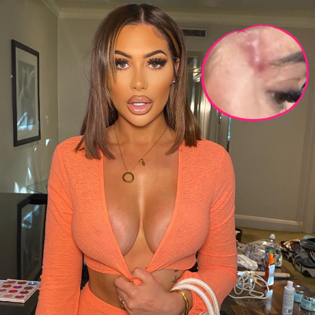 Chloe Ferry, britischer TV-Star