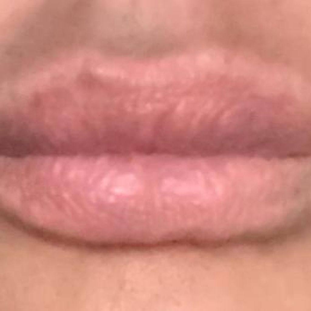 Christina Dimitrious natürliche Lippen