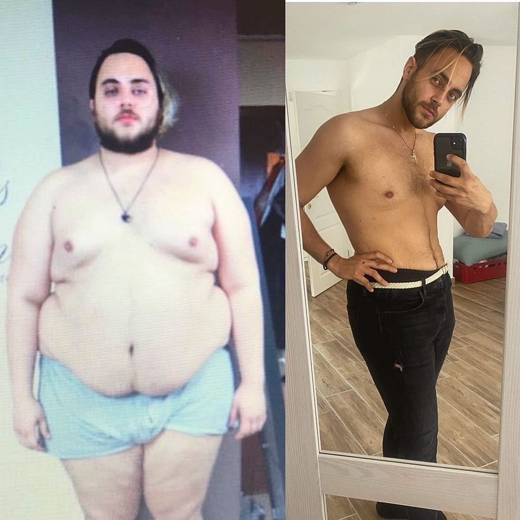 Christos Christodoulou, ehemaliger "The Biggest Loser"-Kandidat