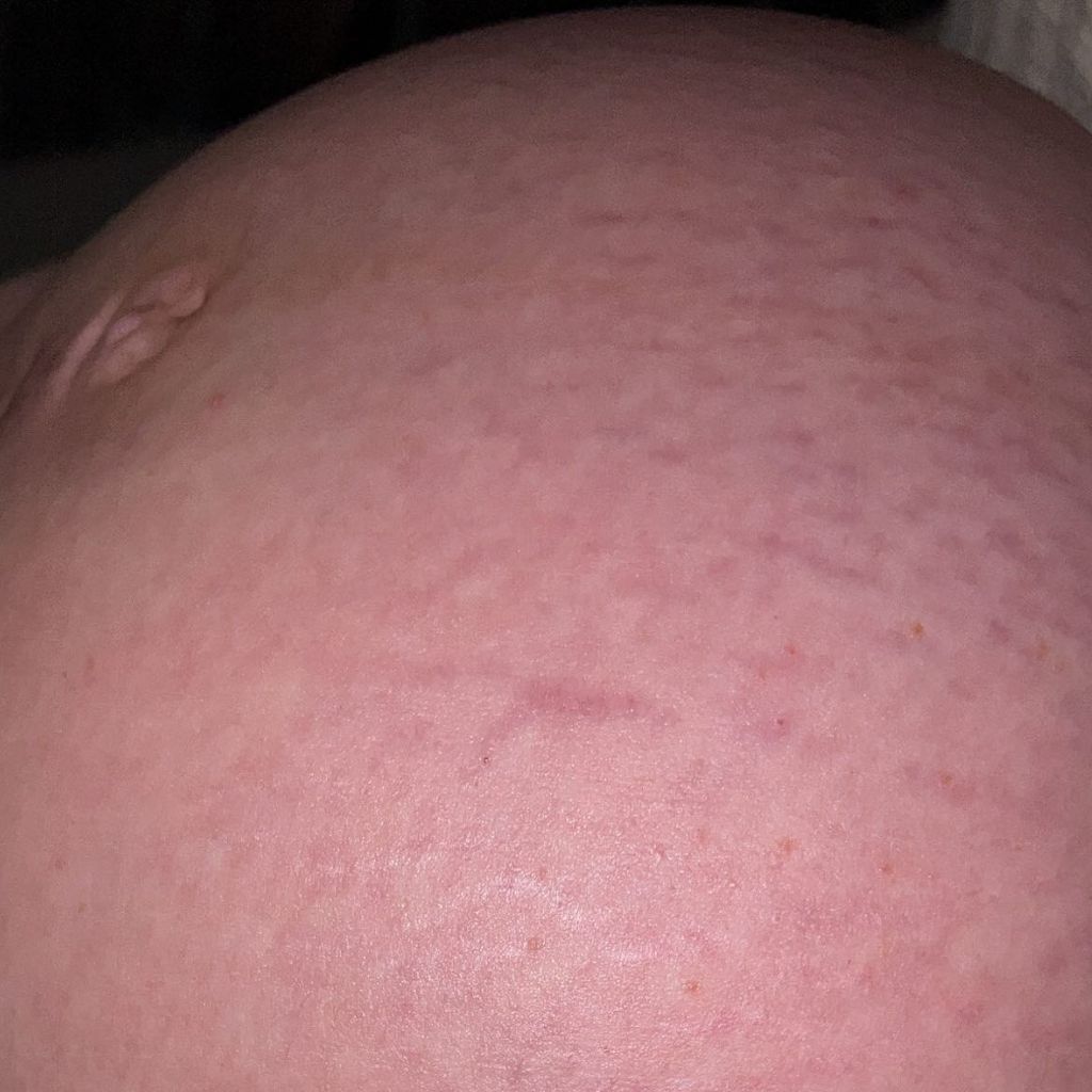 Denise Mskis Babybauch im November 2022