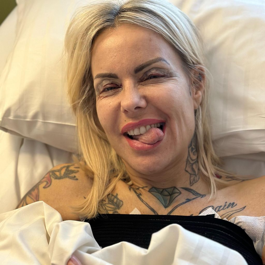 Desiree Hansen nach ihrer Beauty-OP im März 2024