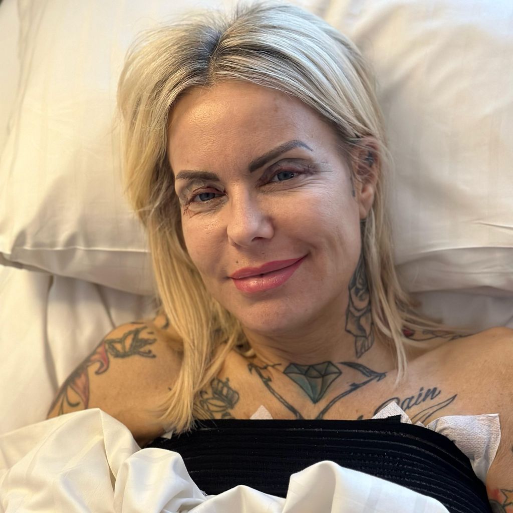 Desiree Hansen nach ihrer Beauty-OP im März 2024