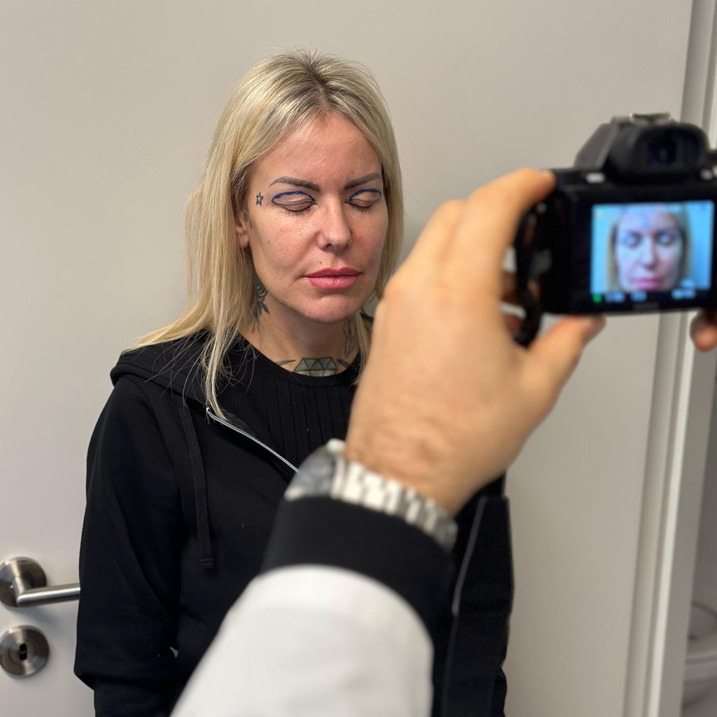 Desiree Hansen vor ihrer Beauty-OP
