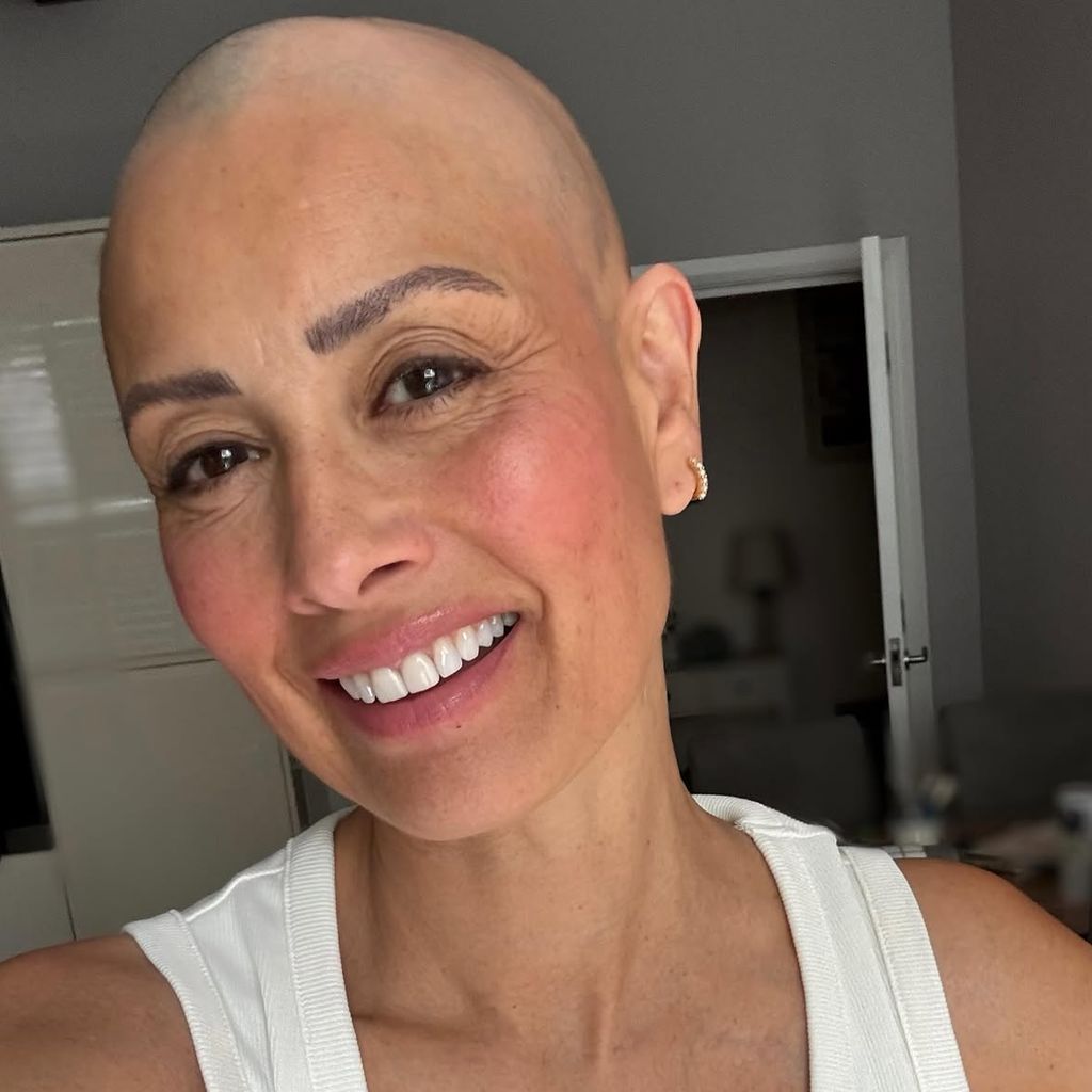 Wegen ihrer Autoimmunerkrankung hat sich die britische TV-Persönlichkeit Melanie Sykes die Haare komplett abrasiert.
