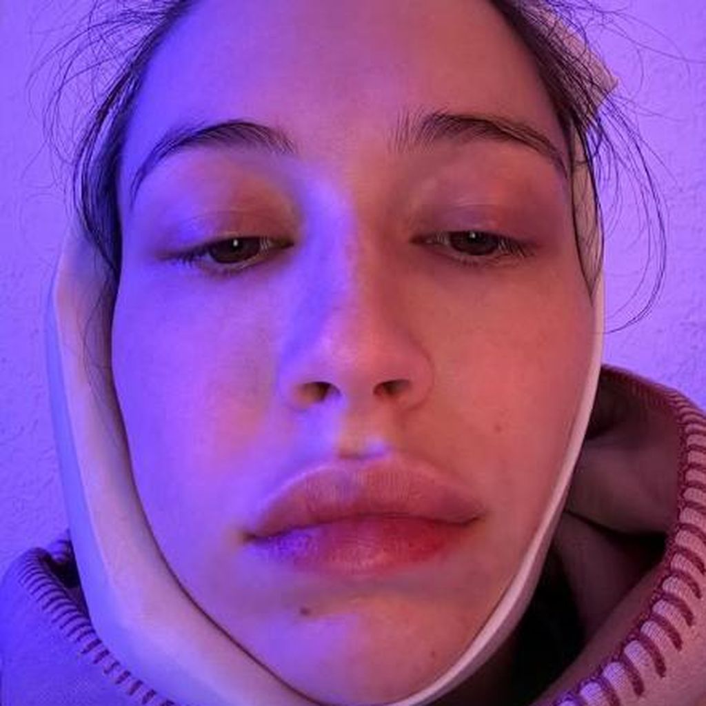 Elsie Hewitt nach der Zahn-OP, Dezember 2025