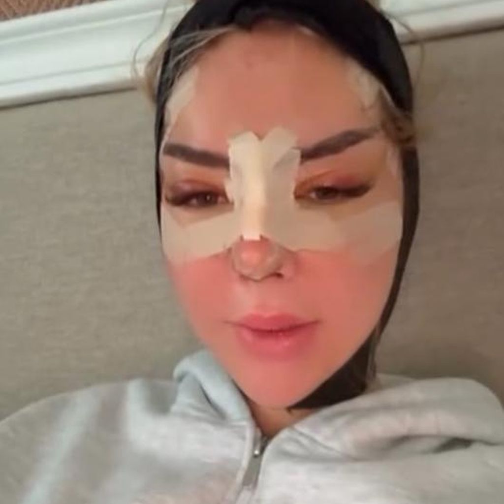 Emma Fernlund wenige Tage nach ihrer Gesichts-OP, November 2025