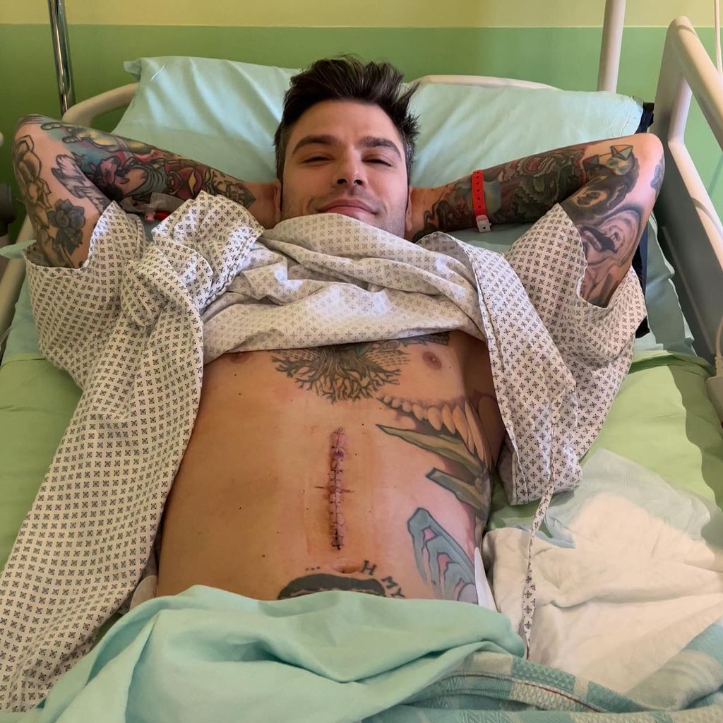 Fedez mit seiner Narbe nach der OP