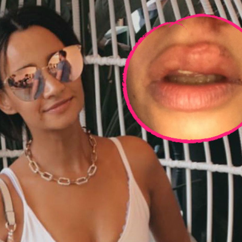Collage Gabby mit geschwollener Lippe