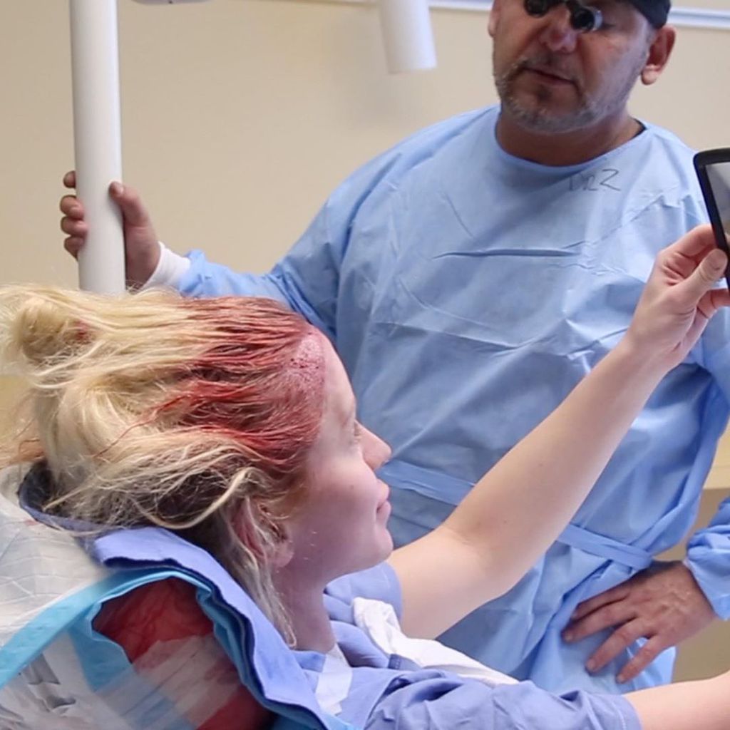 Gigi Gorgeous bei ihrer Haartransplantation