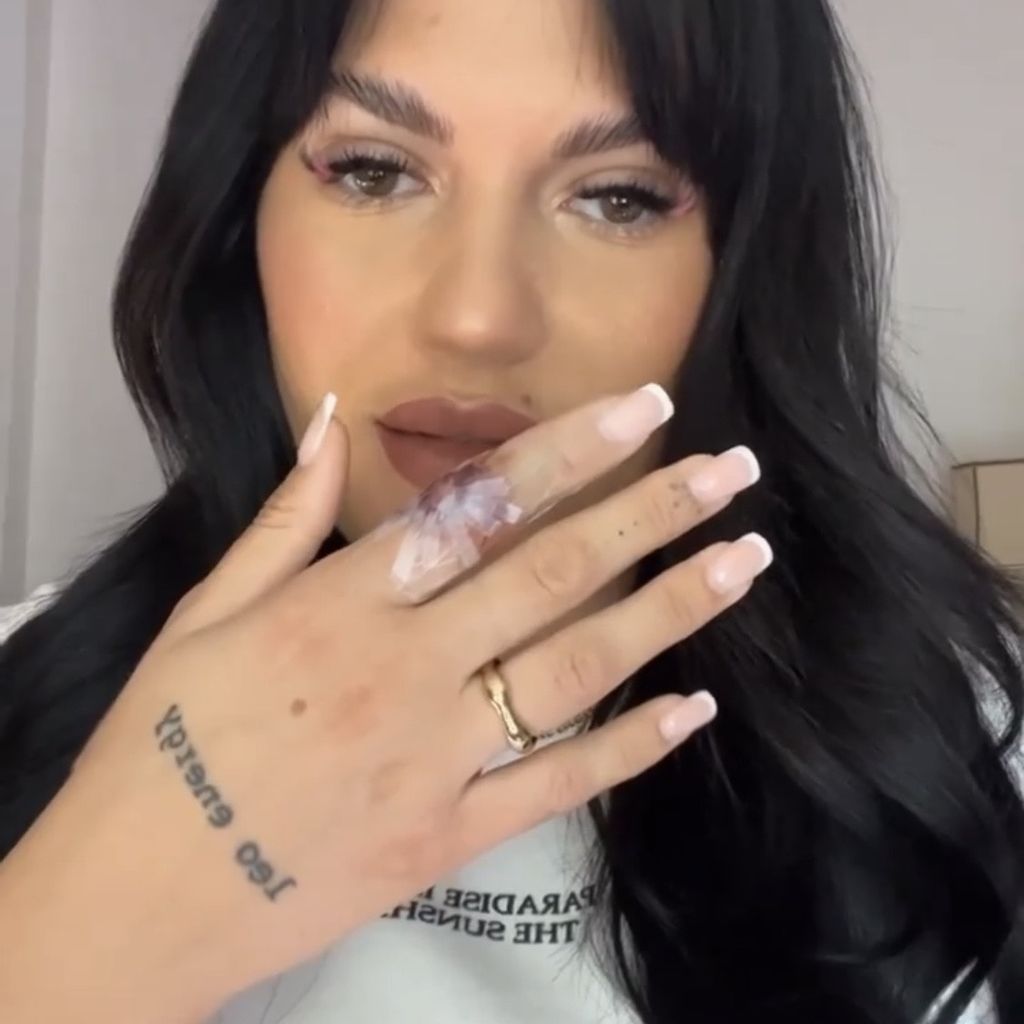 Gina Alicia zeigt ihren verletzten Finger