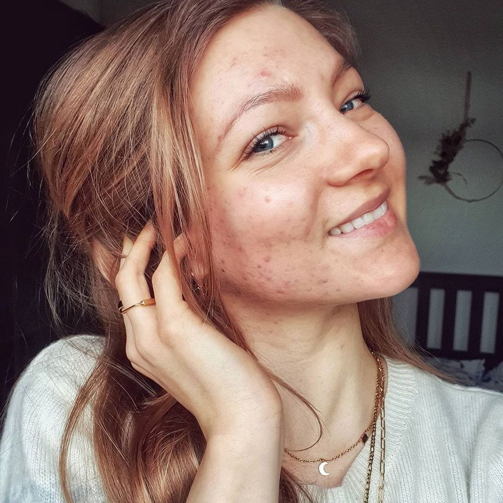 Hanna Bohnekamp, Ex-GNTM-Kandidatin