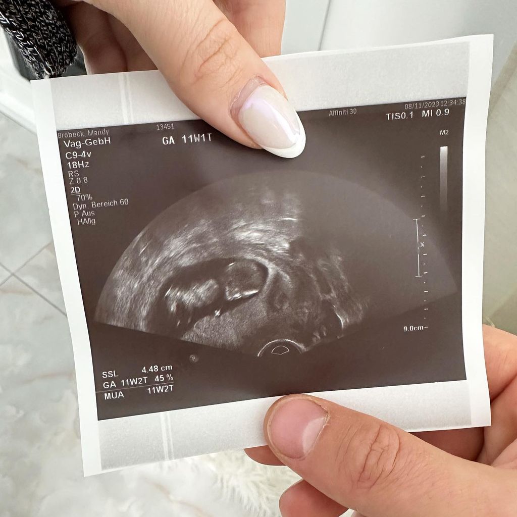 HealthyMandys Ultraschallbild