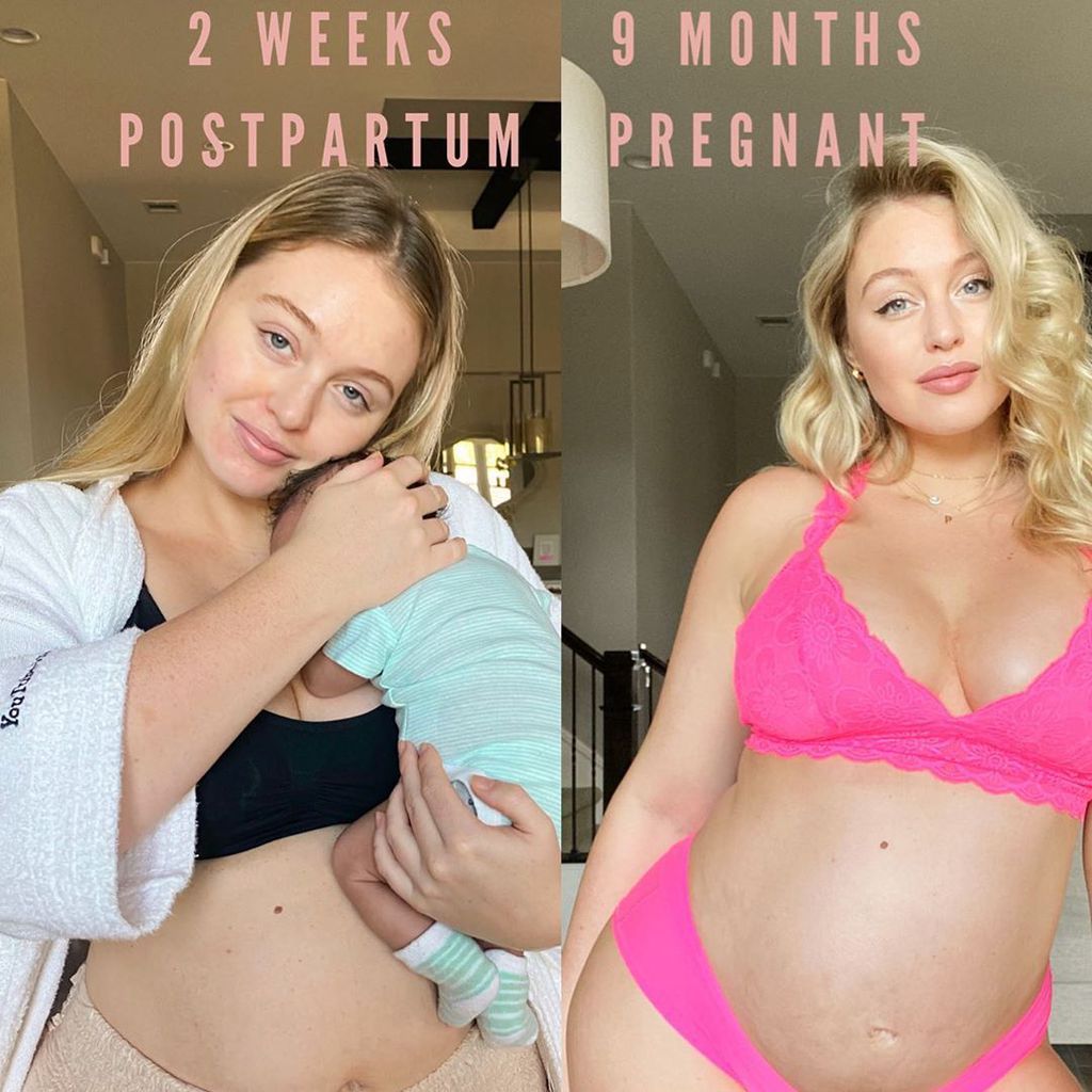 Iskra Lawrence' Vorher-Nacher-Collage