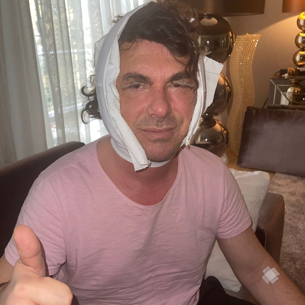 Ismet Atli nach seinem Facelift