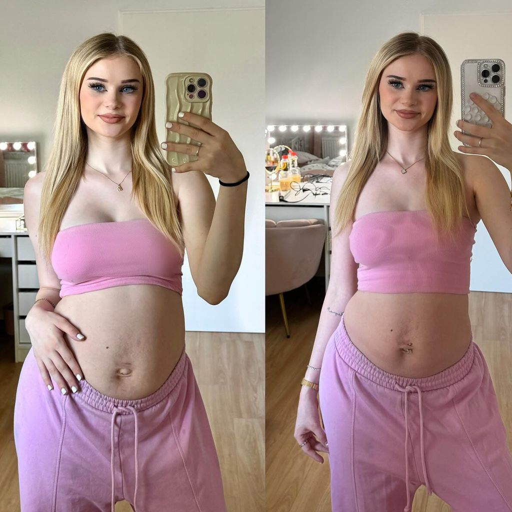 Jasi_xx3s Bauch neun Tage und sieben Wochen nach der Geburt