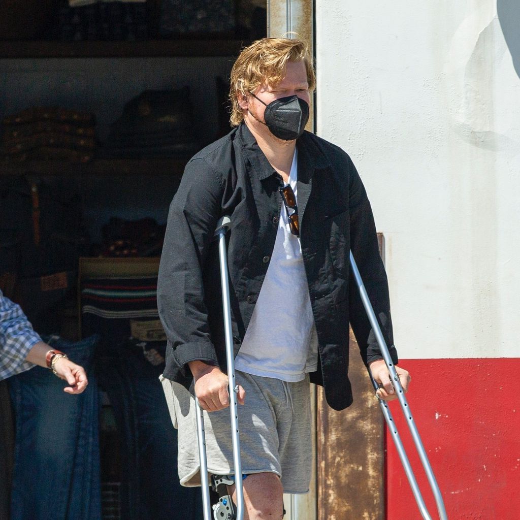 Schauspieler Jesse Plemeons mit Beinschiene