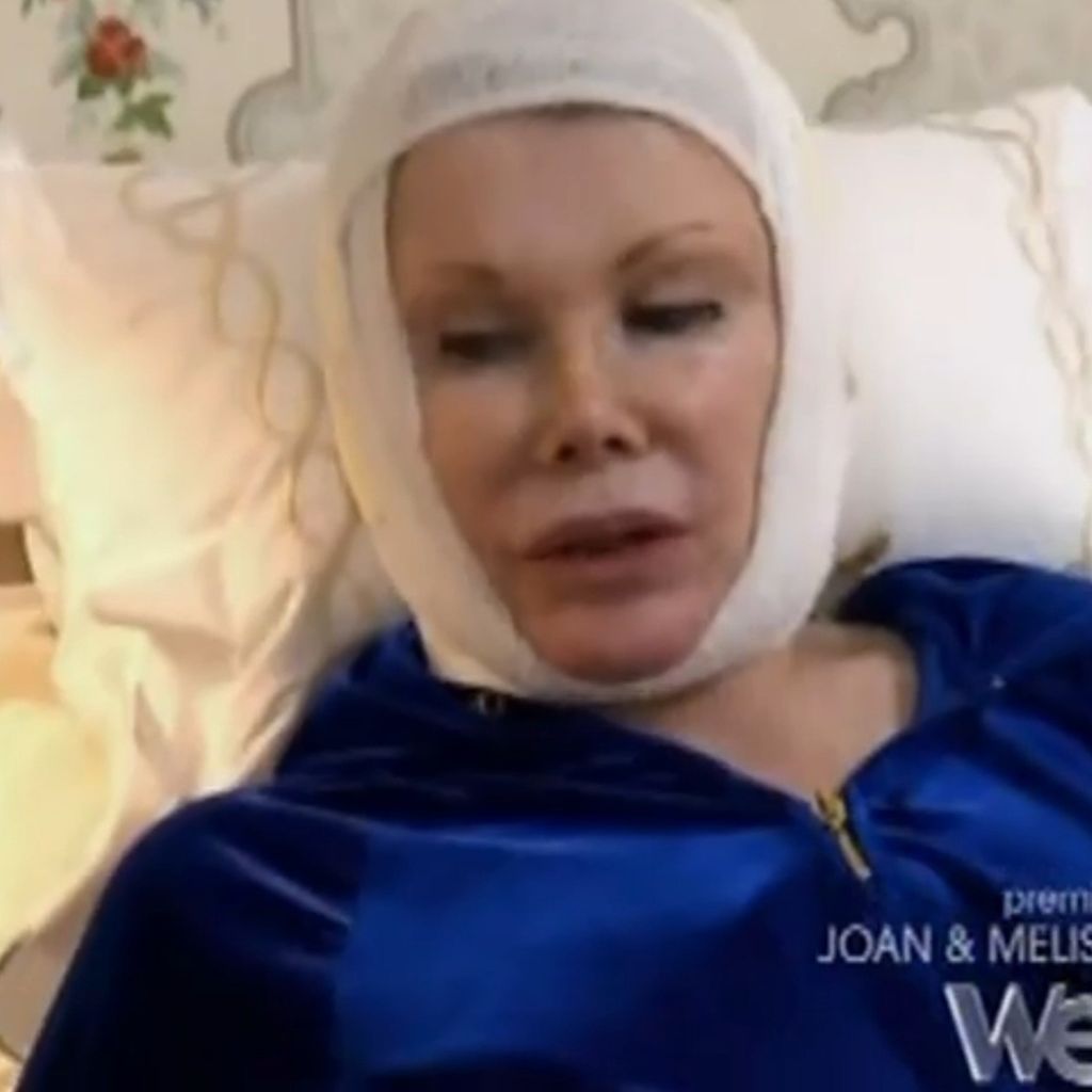 Joan Rivers