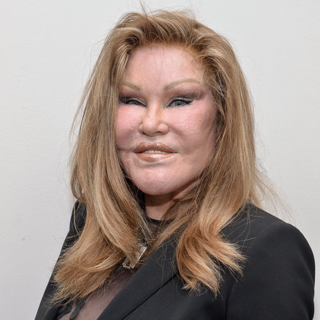 Jocelyn Wildenstein