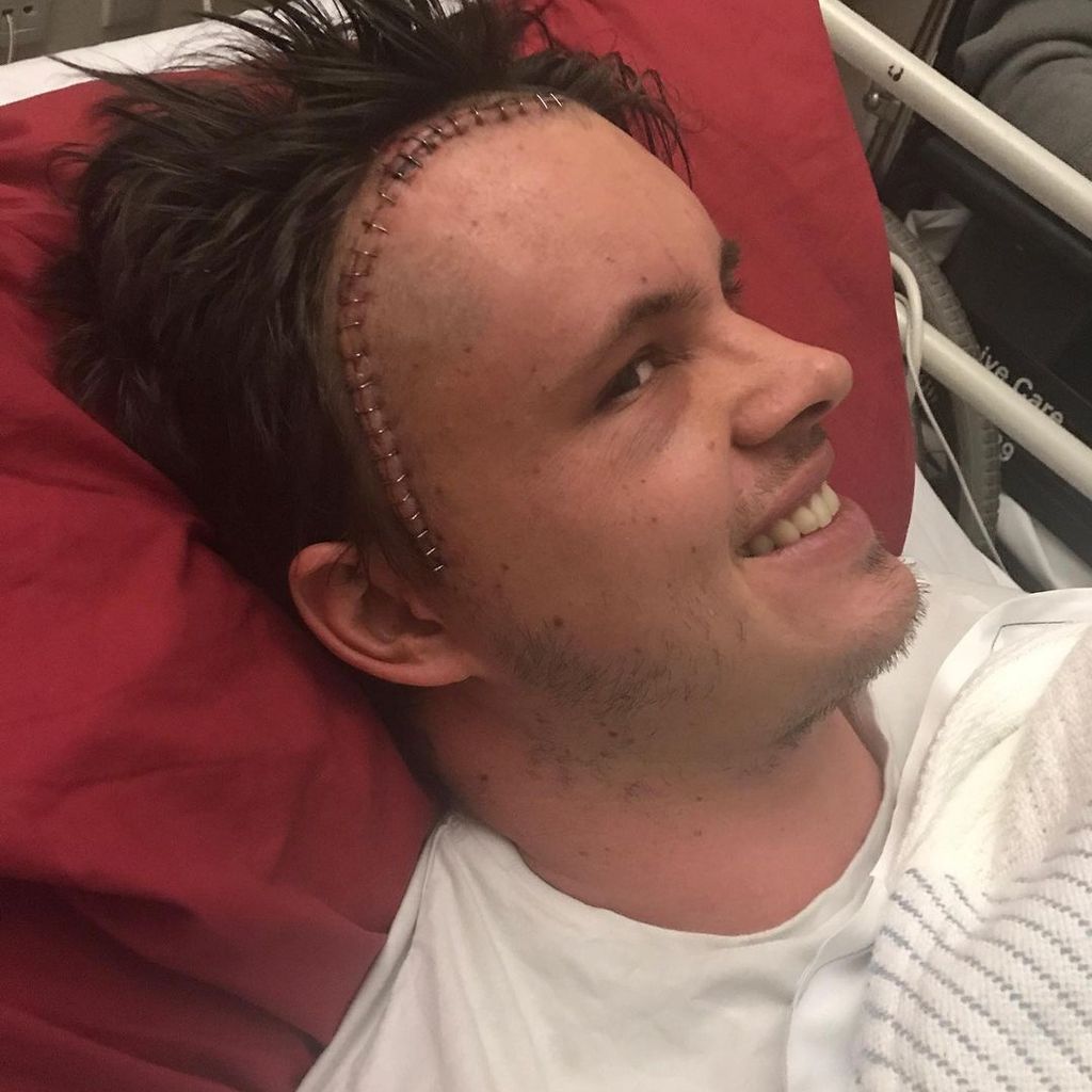 Johnny Ruffo nach seiner Not-OP im August 2017