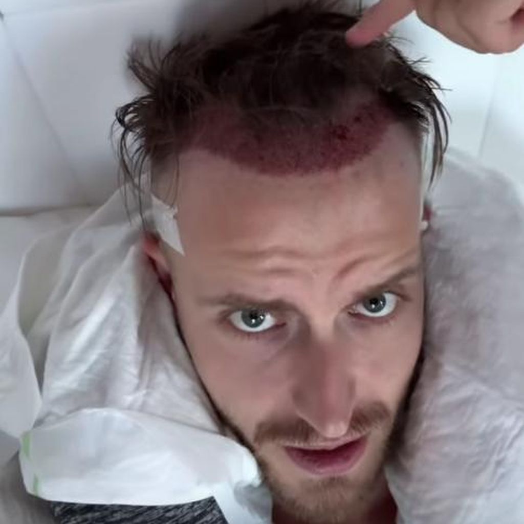 Julian Claßens neue Haare