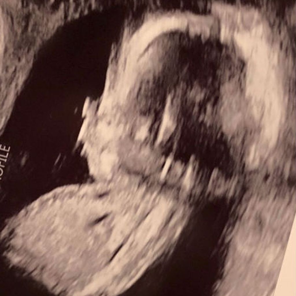 Ultraschallbild von Ashley Grahams Baby