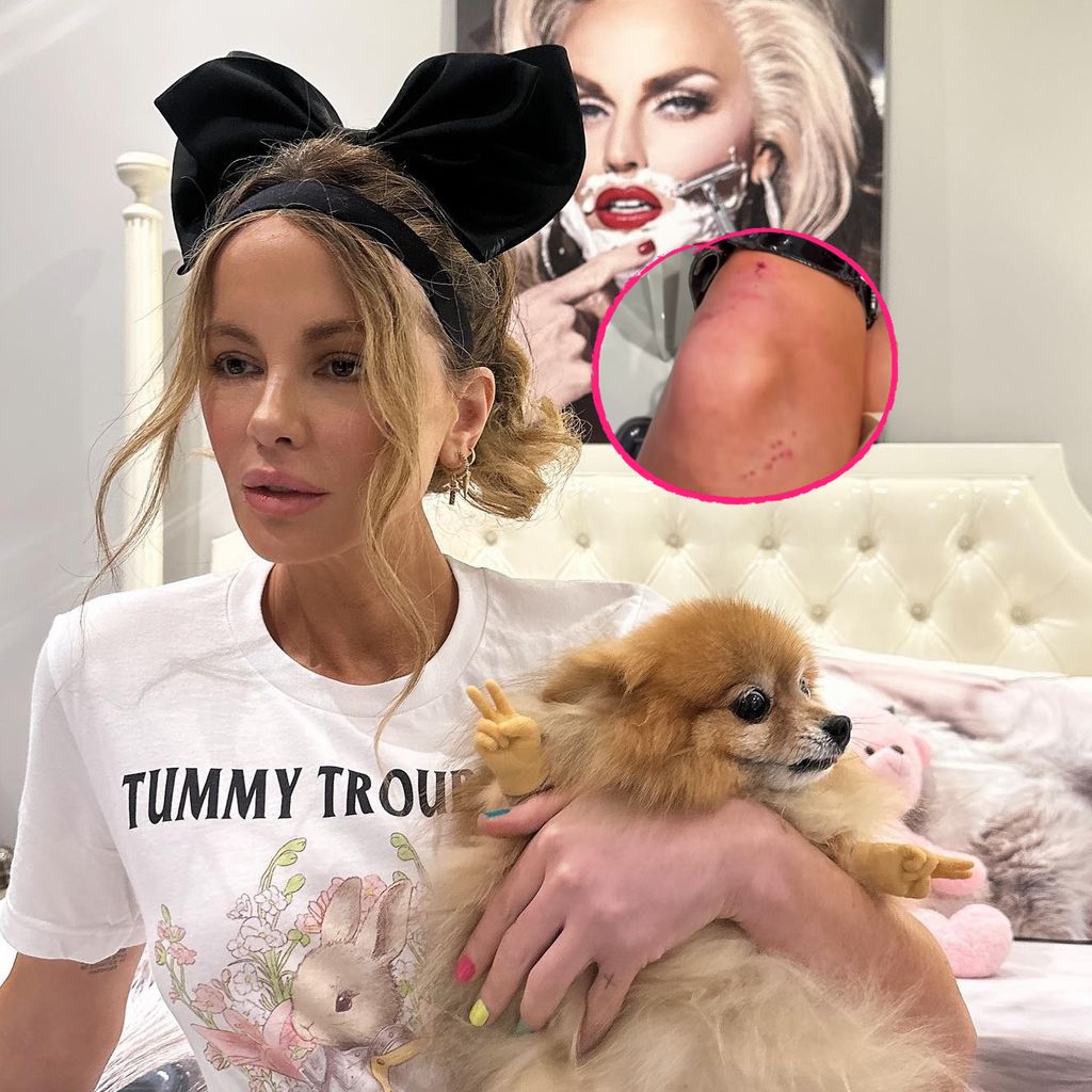 Kate Beckinsale mit ihrem Hund Myf, Collage