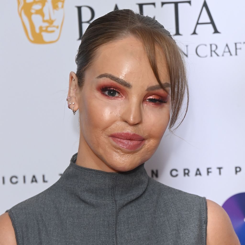 Katie Piper bei den Bafta Awards 2024 in London