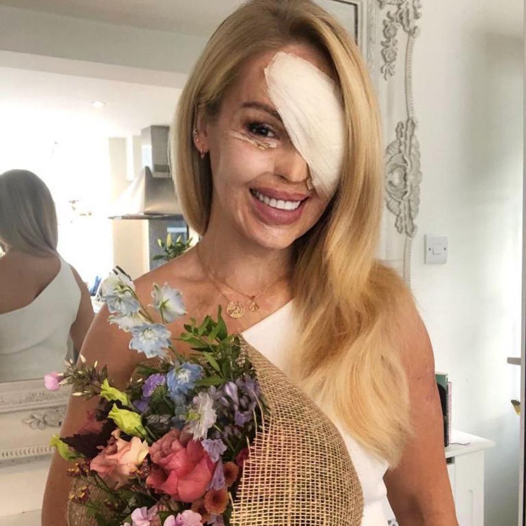 Katie Piper, Juli 2020
