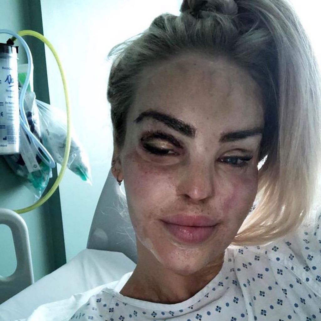 Katie Piper im Oktober 2020