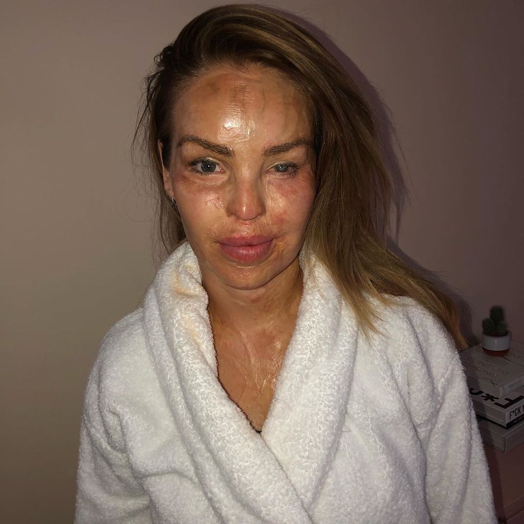 Katie Piper, TV-Gesicht